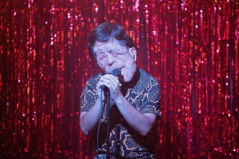 Zdjęcie okładkowe wpisu: Adam Pearson zostanie nowym człowiekiem słoniem