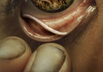 Zdjęcie okładkowe wpisu: Wormtown